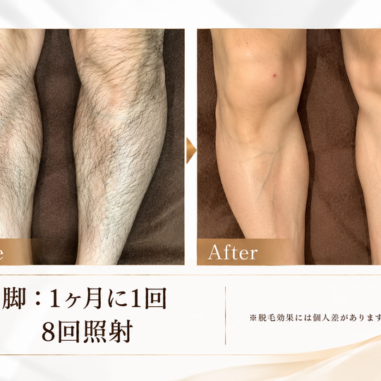 脚脱毛ビフォーアフター比較