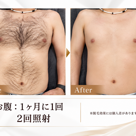 胸腹部の脱毛ビフォーアフター