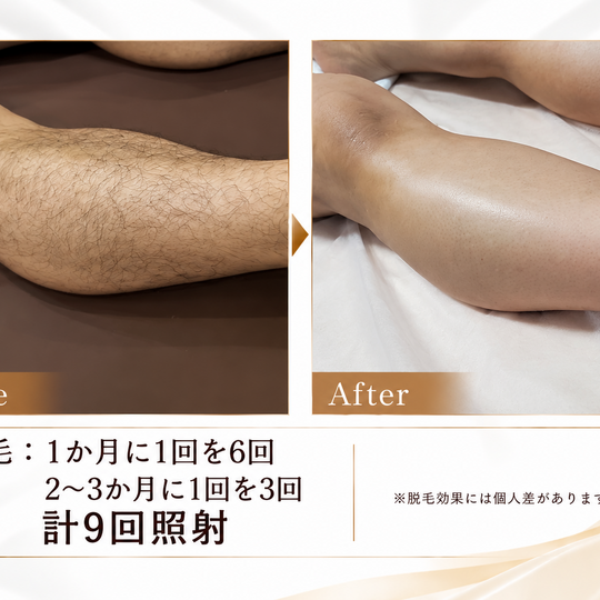 脱毛ビフォーアフター比較#+#+#+#+