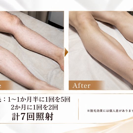 脱毛ビフォーアフター比較広告