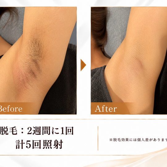 脇脱毛ビフォーアフター比較