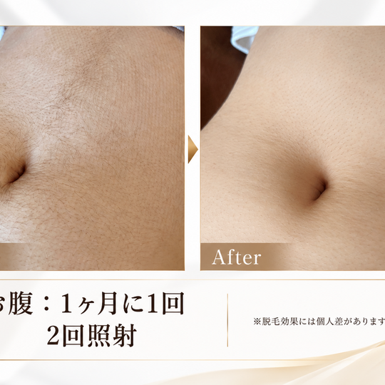 お腹脱毛のビフォーアフター比較